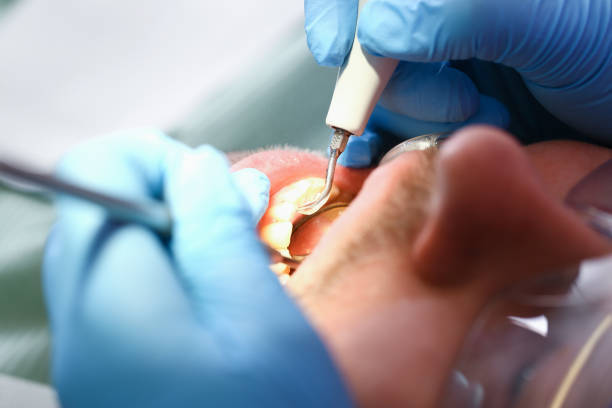 Best Emergency Treatment for Toothache in Lansdowne, VA