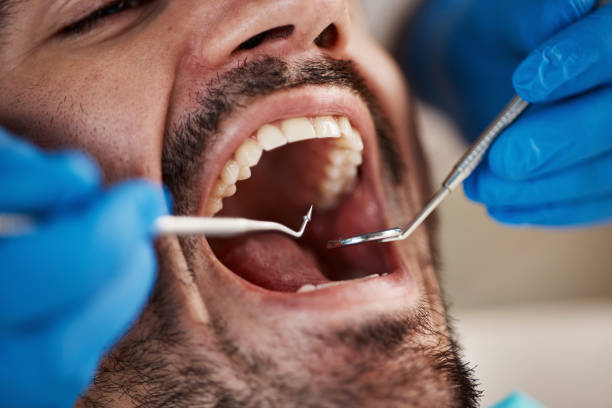 Best After-Hours Emergency Dentist in Lansdowne, VA