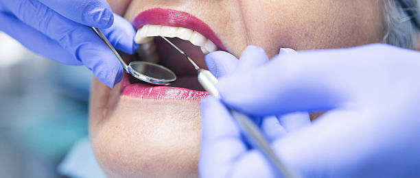 Best Emergency Treatment for Toothache in Lansdowne, VA