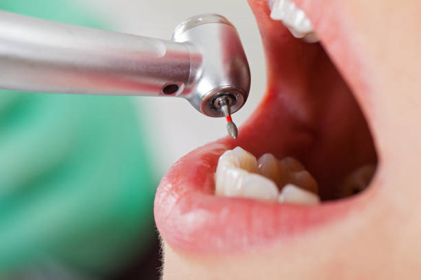 Best After-Hours Emergency Dentist in Lansdowne, VA